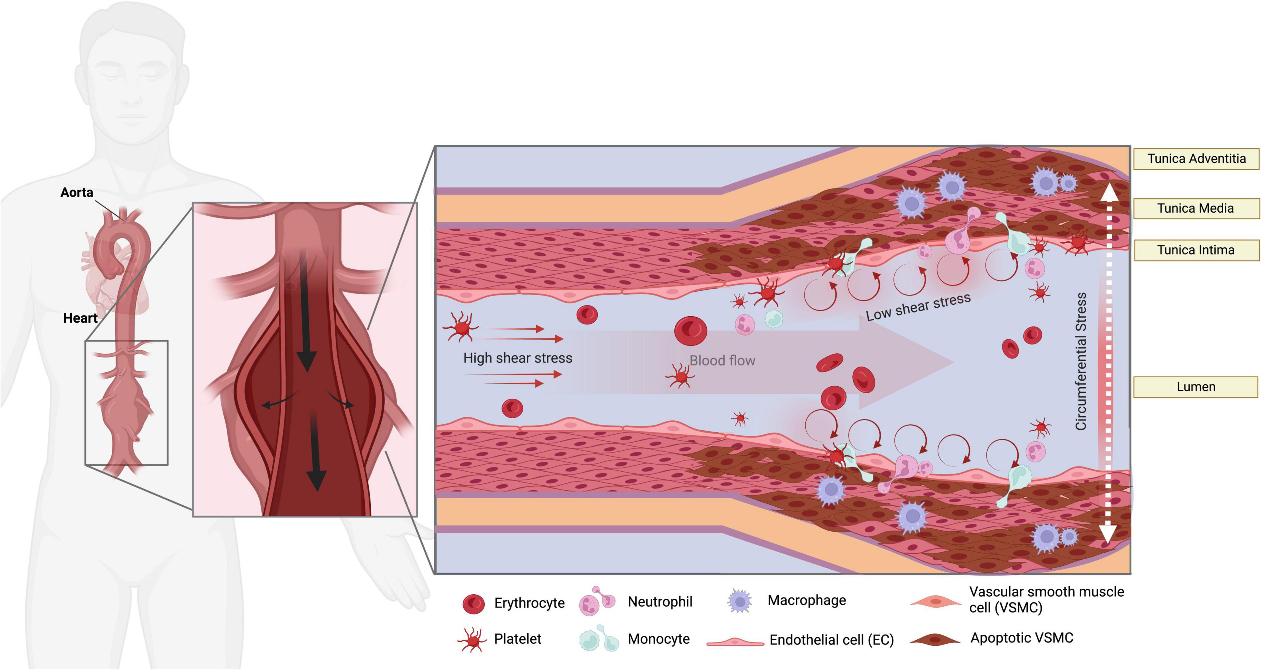 Mechanosignals in abdominal aortic aneurysms